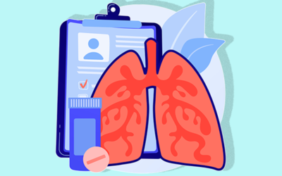 ¿Cómo aliviar los síntomas de la bronquitis?