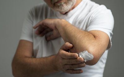 ¿Picaduras de mosquitos o medusas?